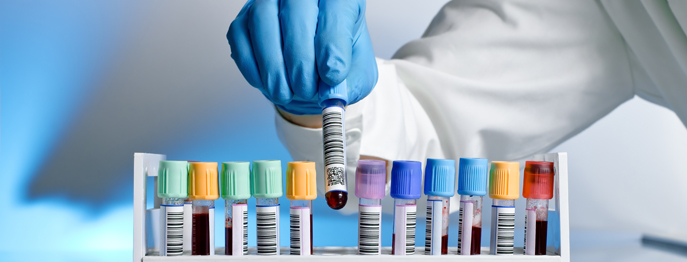 https://www.vetinare.de/media/04/c9/17/1757434633/Labordiagnostik.jpg