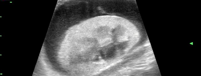 Ultraschall beim Kleintier - Niere